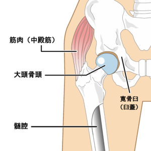 産後に起こる股関節（足の付け根）の痛みの原因とすぐ出来る対処方法！ | 岐阜の産前・産後骨盤矯正「COCOA接骨院」