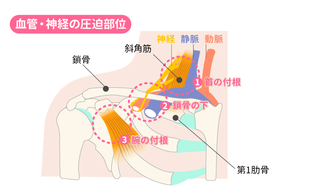 肩付近のイラスト